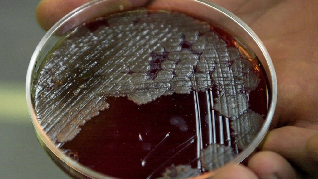 Anthrax bacteria sample