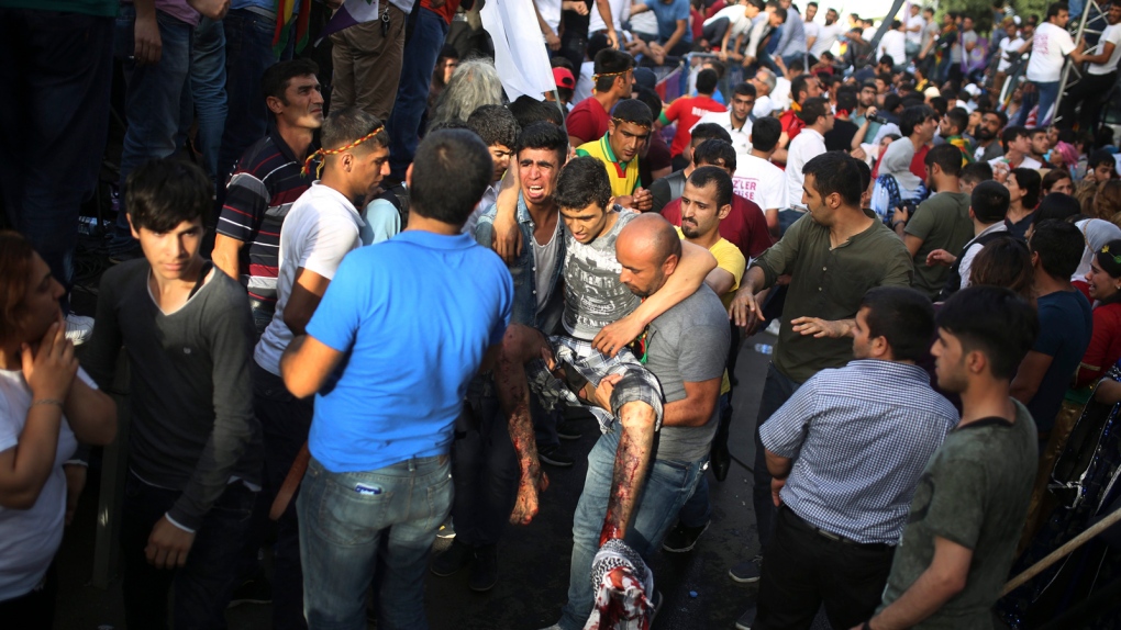 Wounded person at pro-Kurdish rally in Turkey