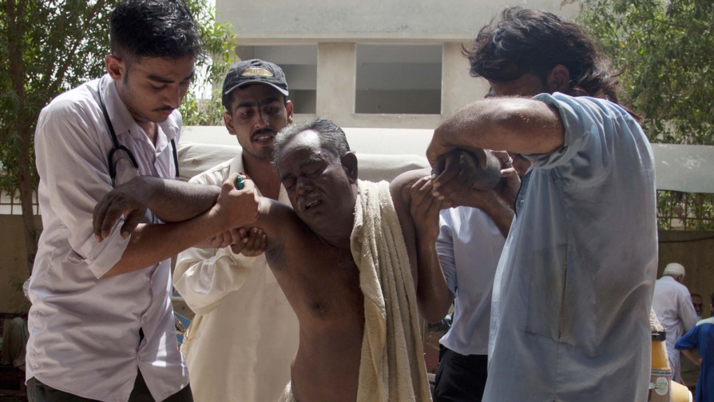 Patient suffering from heatstroke in Pakistan