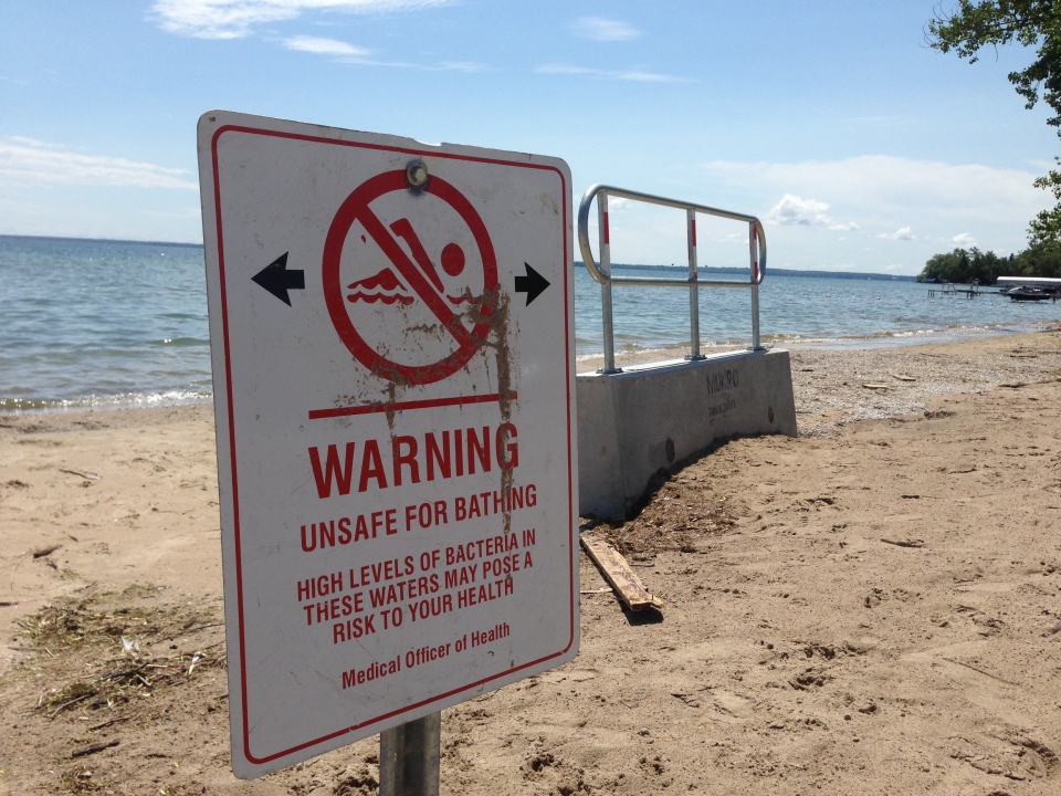 Unsafe for swimming sign in Innisfil