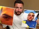 Dan Derikozis shows pictures of his son Eric's injuries in Windsor, Ont., on July 13, 2015. (Sacha Long / CTV Windsor)