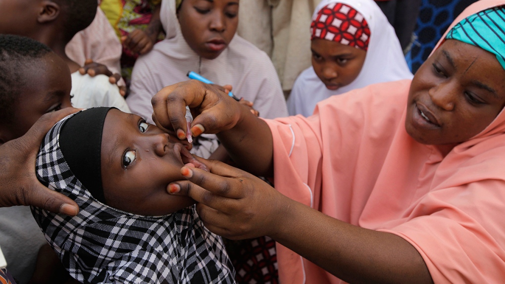 A polio vaccine is administered in Nigeria