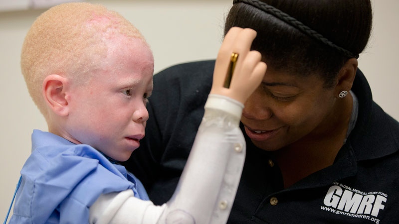 Baraka Lusambo of Tanzania has albinism
