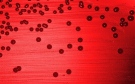 A blood agar plate culture of Haemophilus influenzae is shown in this undated handout photo. (Handout / Centers for Disease Control and Prevention)