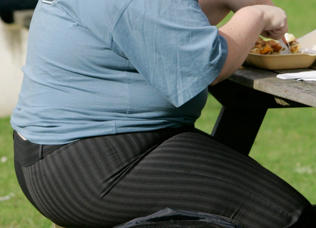 Scientists find gene glitch that leads to obesity