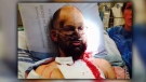 Chad Dueck remains in hospital after surviving an encounter with a grizzly bear near Cranbrook