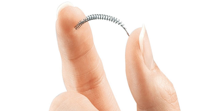 Bayer birth control implant Essure