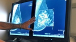 A radiologist compares an image from a 2-D technology mammogram to 3-D Digital Breast Tomosynthesis mammography in Wichita Falls, Tex., on Tuesday, July 31, 2012. (Torin Halsey/Times Record News via AP)