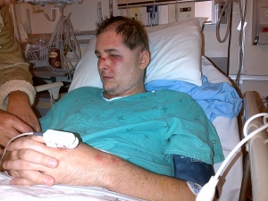 Ryan Turcotte recovers after being attacked at a plaza in Barrie in June of 2012. (Court exhibit)