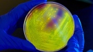 A researcher holds C. difficile bacteria in a petri dish in an undated photo. (Centers for Disease Control and Prevention/THE CANADIAN PRESS)