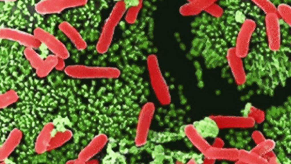 New MCR-1 superbug found in Canada