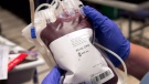 A bag of blood is shown at a clinic in Montreal on Thursday, Nov. 29, 2012. (Ryan Remiorz / THE CANADIAN PRESS)