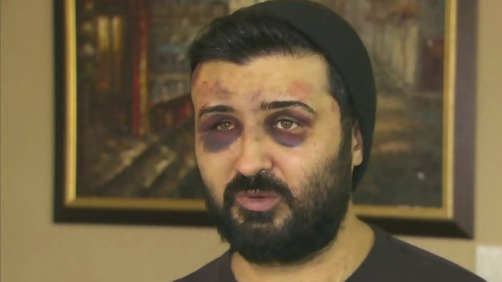 CTV Toronto: Man tells story of kidnapping 