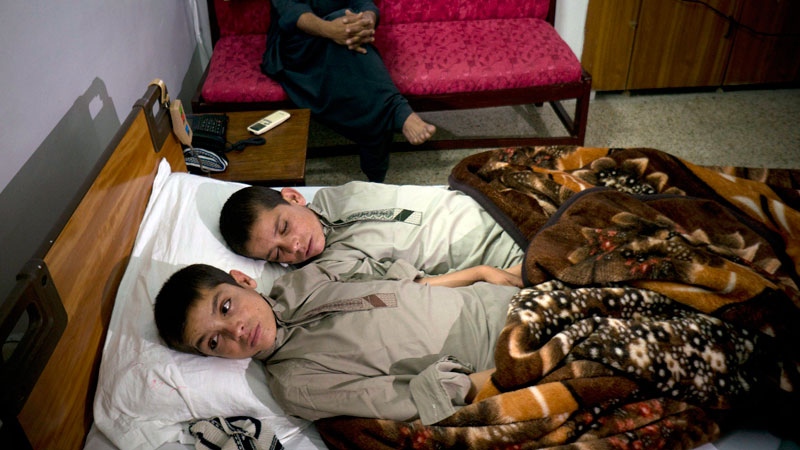Abdul Rasheed, 9, front, and Shoaib Ahmed, 13, lie in a bed at a hospital in Islamabad, Pakistan on Thursday, May 5, 2016. (AP /B.K. Bangash)