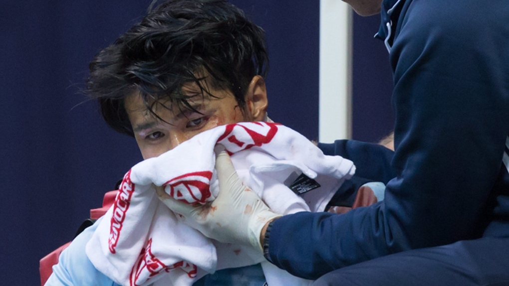 Vancouver Whitecaps' Masato Kudo injury