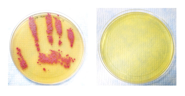 Colonies of the superbug MRSA (photo at left) which grew after a health-care worker's hand was imprinted on a plate of growth medium. (New England Journal of Medicine / THE CANADIAN PRESS)  