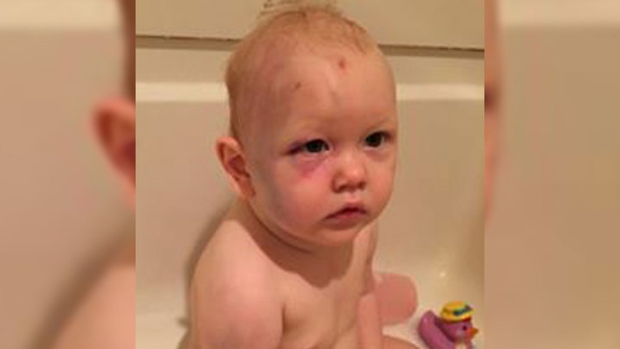 Father's Facebook post seeking justice for abused baby ...