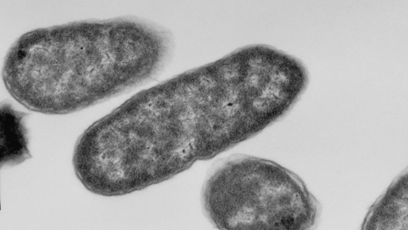 Electron micrograph images of E.coli 