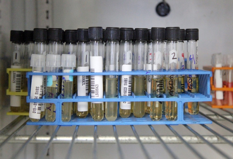 Avian influenza testing samples are shown in the University of Minnesota’s Veterinary Diagnostics Laboratory in St. Paul, Minn., on Wednesday, April 8, 2015. (AP Photo/Minnesota Public Radio, Riham Feshir )