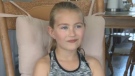 A young Nova Scotia girl is speaking out to raise awareness about amputees. 