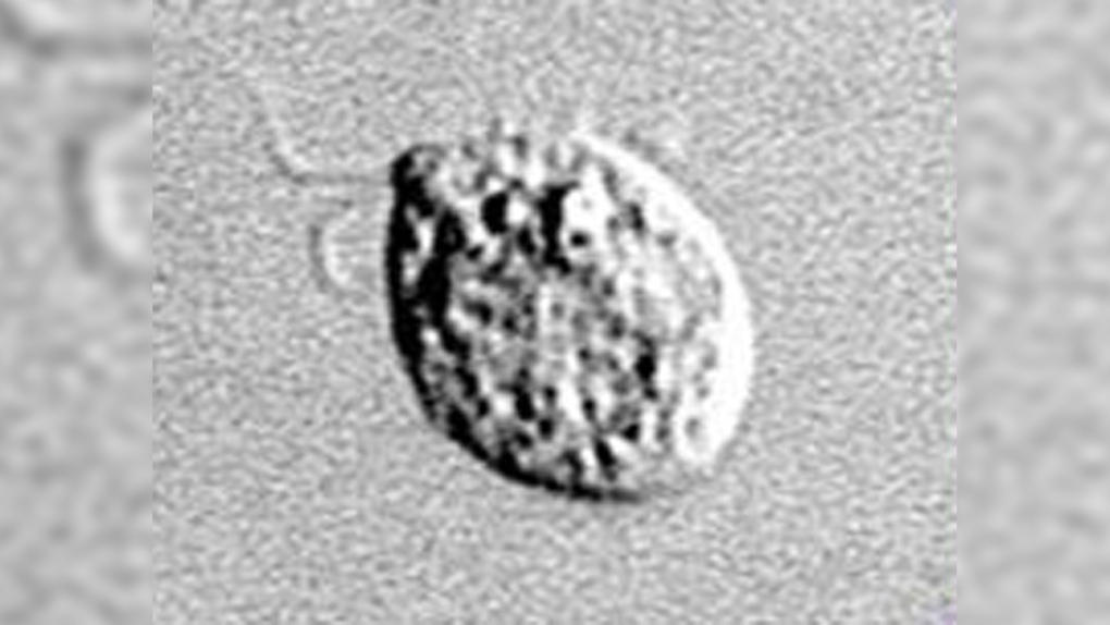 Naegleria fowleri amoeba