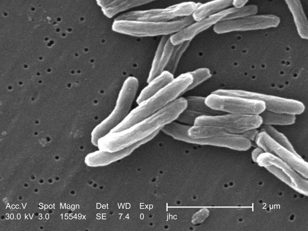 Tuberculosis bacteria is seen under the high magnification of a scanning electron microscope in this image made available by the U.S. Centers for Disease Control and Prevention.