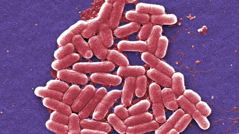O157:H7 strain of the E. coli bacteria