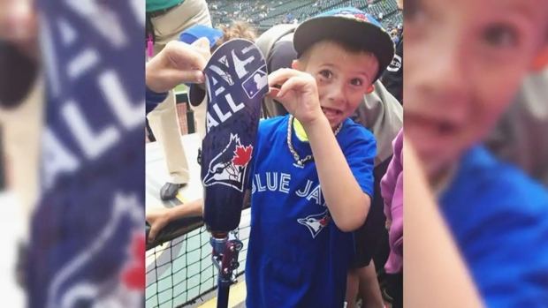 Blue Jays treat Alberta boy with prosthetic leg autographed by team to ...