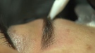 An esthetician uses a small blade to administer tiny cuts to inject ink in or around the client’s eyebrows.