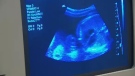 The image from an ultrasound scan is seen in this file photo.