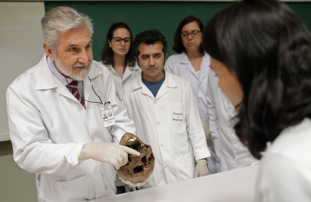 Daniel Munoz holds skull of Josef Mengele 