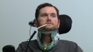 Troy Kraus at Ottawa Hospital Rehab Centre in February 2017. He fell on ice in January 2017 and broke his neck in four places. 