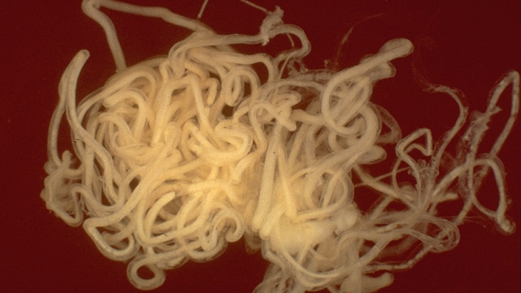 Parasitic worm may be cause of mysterious seizure disorder in children