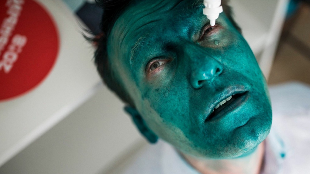 Alexei Navalny with a green face