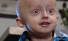Alex Whitford, 5, is believed to be the only child in Canada with progeria. (Photo: Carmen Liebel / Twitter) 