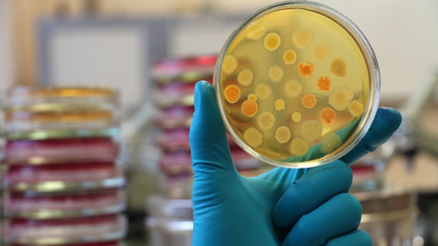 Bacteria are shown on a Petri dish.