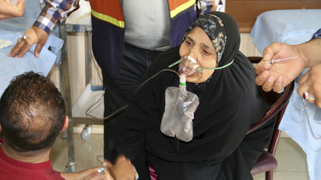 Iraqis exposed to chemical attacks