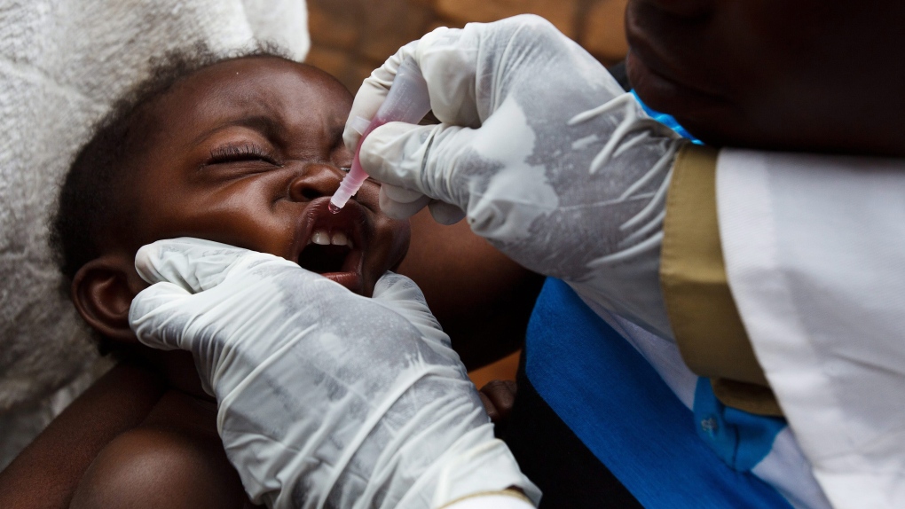 Congo polio 