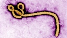 In this undated colorized transmission electron micrograph file image made available by the CDC shows an Ebola virus virion. (Frederick Murphy/CDC via AP, File)