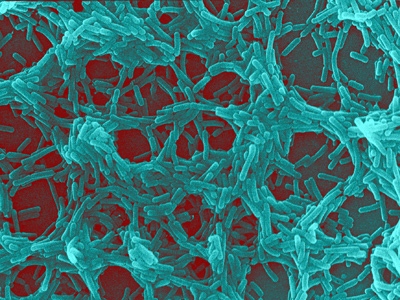 This undated photo released and color enhanced by the Rowett Research Institute in Scotland shows Lactobacillus bacteria observed in a scanning electron microscope. Billions of 'friendly' bacteria called probiotics, like these Lactobacillus bugs, are being put in commercial foods including yogurts, cheeses, baby formula and even chocolate. It's part of a growing trend of foods claiming to enhance health. (AP / Rowett Research Institute)