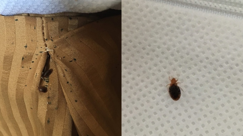 bed bugs at North Vancouver hotel