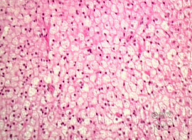 'Brown fat,' seen here under a microscope, seems to be concentrated around the neck and is active in burning energy to generate heat. 