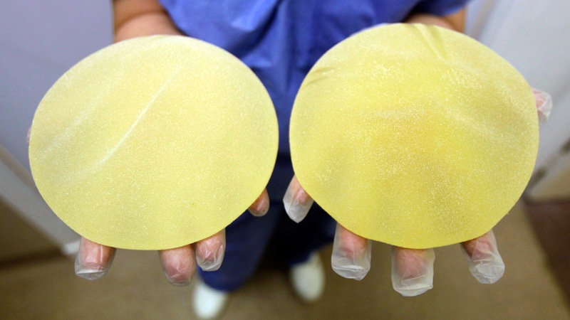Defective breast Poly Implants
