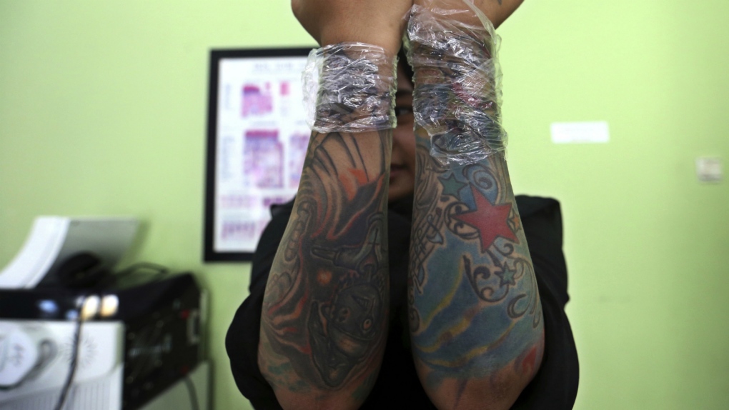 Muslims get tattoos removed in Indonesia