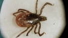 Ticks can carry Lyme disease, as well as other tick-borne illnesses. (Victoria Arocho/AP Photo)