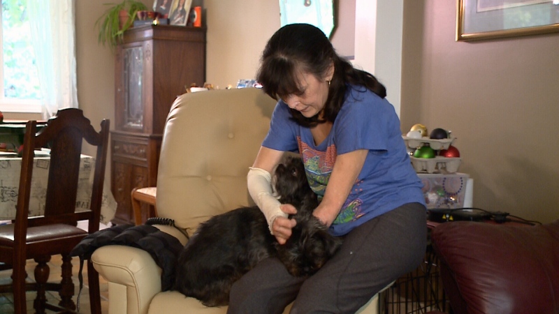 Christine Caron lost 3 limbs due to septic shock.