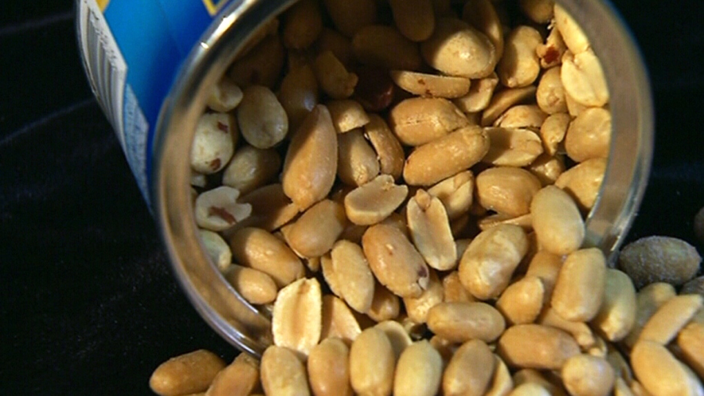New moms’ diets may affect kids’ peanut allergies