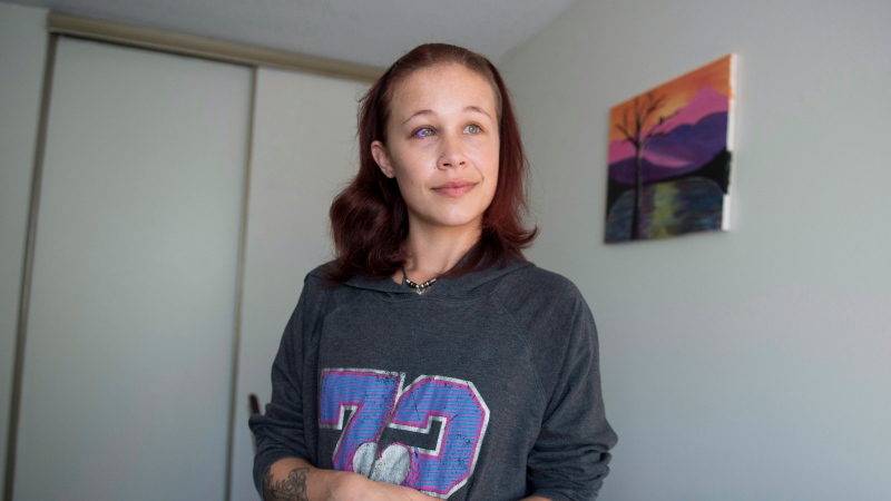Catt Gallinger, who had a botched ink injection in her eyeball, at home in Ottawa on Friday, Sept. 29, 2017. Medical professionals and body artists say the practice of tattooing the eyeball, which recently left an Ottawa woman facing the prospect of vision loss, is on the rise despite its many risks. THE CANADIAN PRESS/Justin Tang