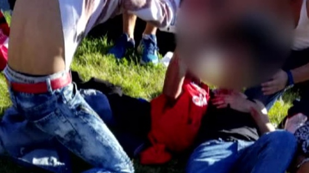 A teenage boy is seen on the ground near a Scarborough high school after he was stabbed on Oct. 17, 2017. His face has been blurred due to the graphic nature of the content as well as to protect his identity. (Provided)