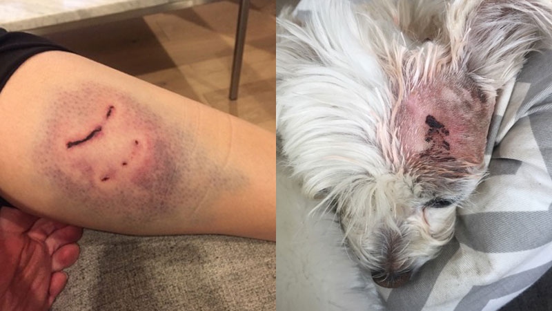 Anne Hurwitz's injured leg (left) and her dog (right) is shown in these provided images.
